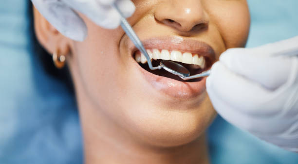 Best Walk-In Emergency Dentist in Canton, OH